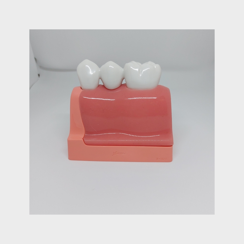 Maxi Implantat/Bro Studiemodel 